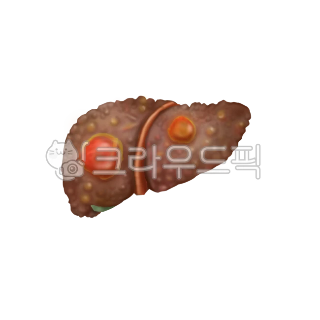 간암, 종양, 간질환, 메디컬, 해부학, 사진,이미지,일러스트,캘리그라피 - Nchuccida작가 크라우드픽 - 저작권 걱정 없는 상업용 이미지